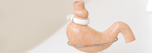 Magen Op Türkei – Der schnellste Weg zu einer neuen Lebensqualität